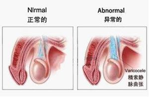 患者老婆：我以后再也不会喊他“蚯蚓男”了